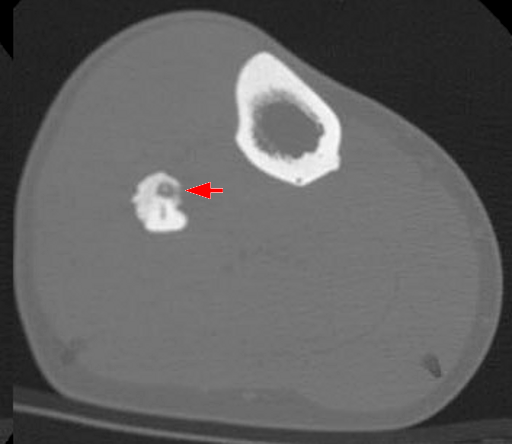 example of a ct scan