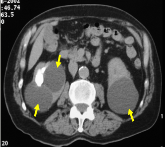 example of a ct scan